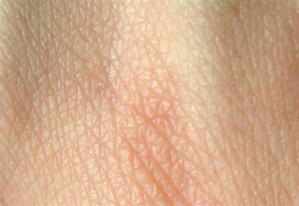 Human _skin _structure